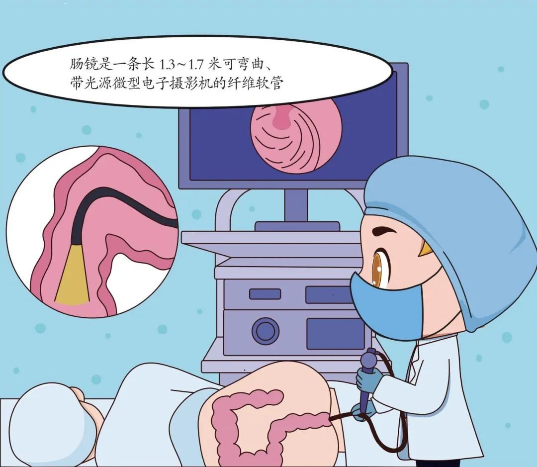 无锡医博肛泰肛肠医院肠镜